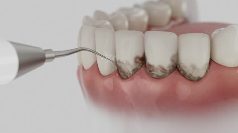 Trusted Tooth Extraction service in Reinholds, PA - Dentist Open Now